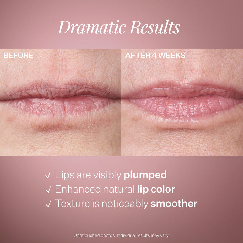 Double Fix™ for Lips Plumping & Vertical Line Treatment, , hi-res